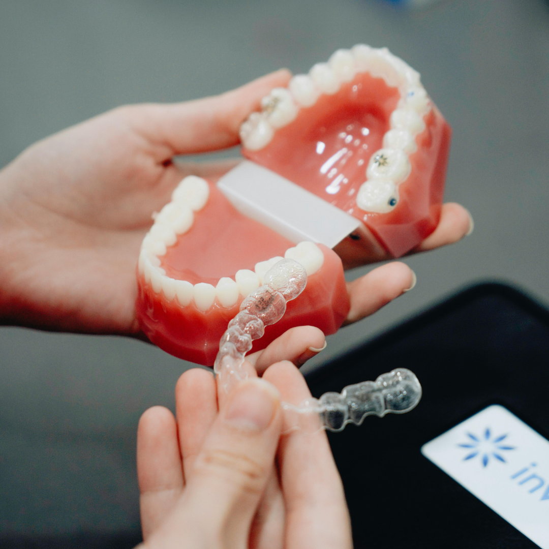 teeth-shifting