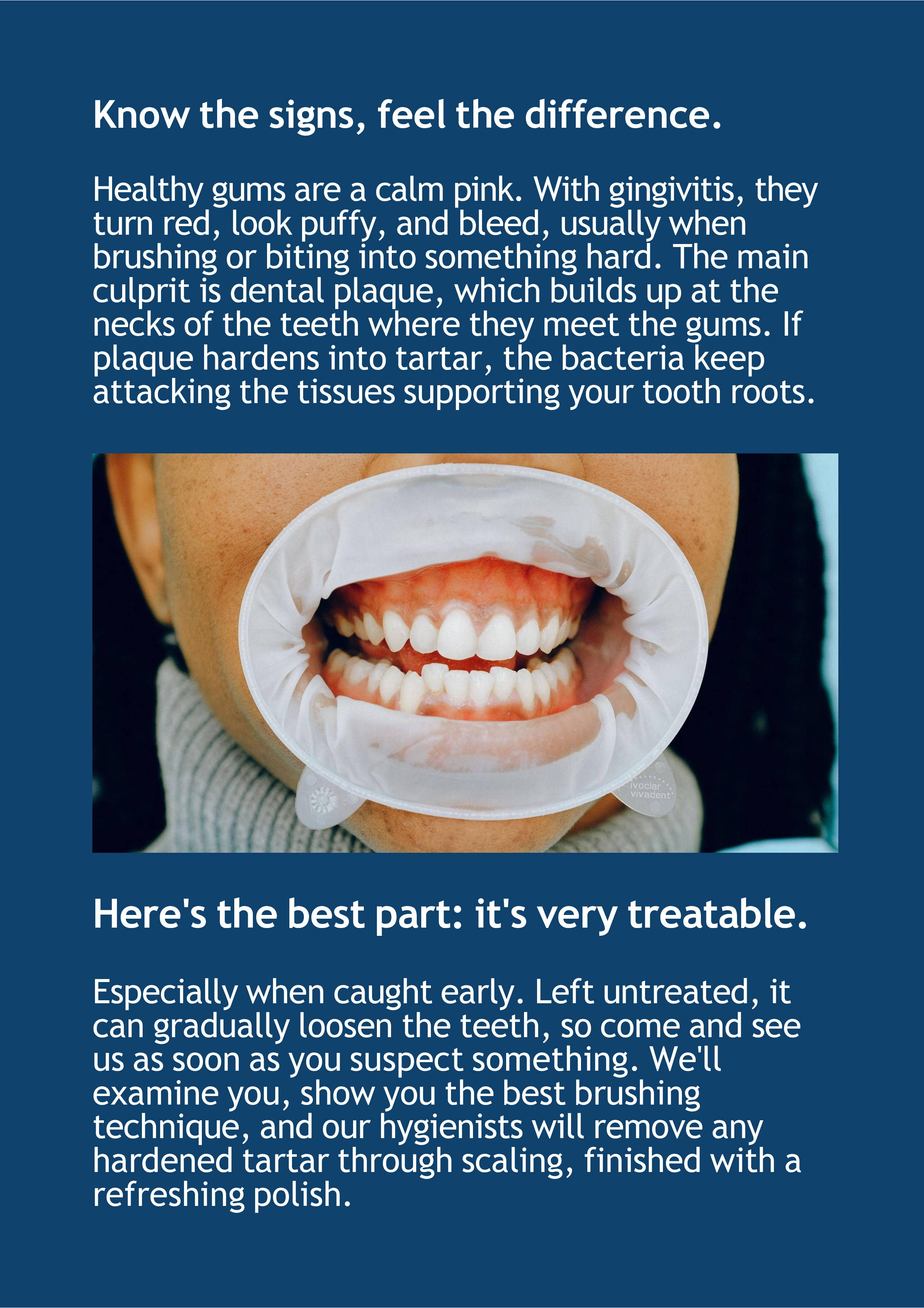 signs-of-gingivitis